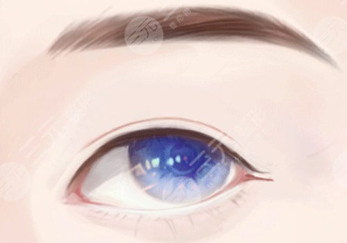 覃方燕双眼皮多少钱