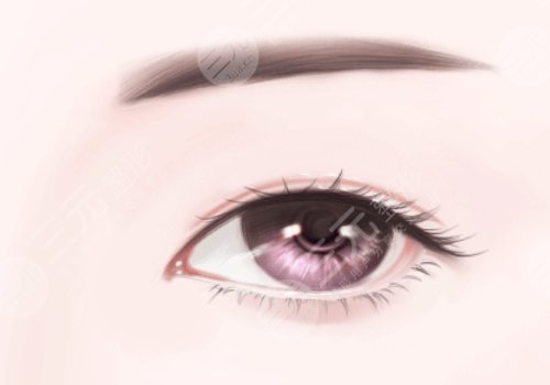 覃方燕双眼皮多少钱