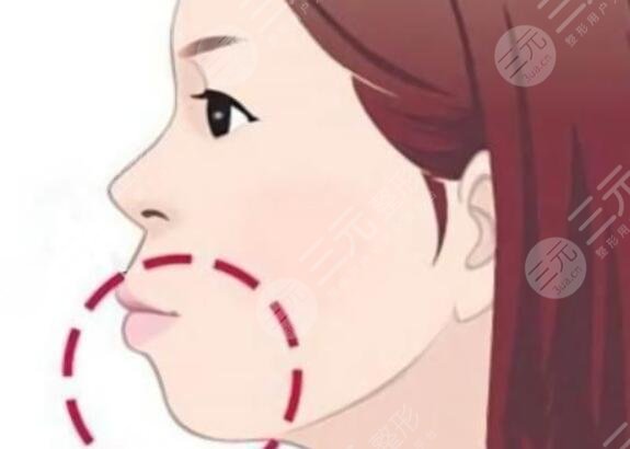 正颌