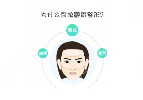 上海第九人民医院颧骨内推手术 