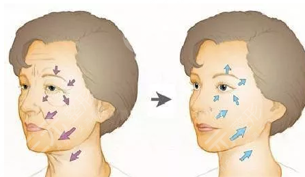 3、上海第九人民医院整复外科医生介绍 丁伟 丁伟:男,在医院担任副主任医师,在复旦大学毕业之后就参加了工作,曾经到美国留学获得了博士学位。在整形美容方面有着自己的个性化追求,主张自然以及人文美学相互结合的整形方式可以带来更精致的整形美容结果。尤其比较擅长面部年轻化整形、面部手术提升等。 张英 张英:女,主任医师。在上海交通大学医学院毕业,从事整形美容行业工作20多年,担任了不少的社会认知,而且还发表了40多篇论文,针对各种整形美容都是比较擅长的,针对面部提升手术以及下颌线塑形手术,有着自己的诊疗特色。比较主张自然以及细致化的手术风格,帮助不少的爱美者完成了手术。 4、上海第九人民医院整复外科特色项目 拉皮 拉皮手术:做拉皮手术的时候,可以在比较隐蔽的地方做切口,然后将多余的脂肪组织进行切除,然后对局部进行提拉,再将伤口缝合,这样就能够解决皮肤松弛下垂的问题。做完拉皮手术之后,局部也有可能会出现创伤,需要做好相关的护理,通常1~3个月才能够恢复手术,之后能够让皮肤变得更加紧致,达到了年轻化的目的。但是在伤口恢复期间不能用手去按压,饮食要清淡,做好了护理之后恢复起来才会更快。