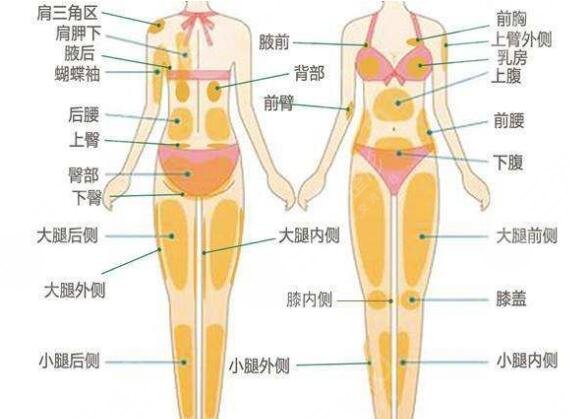 抽脂肚子价格大概多少