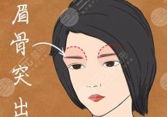 打眉弓用什么品牌玻尿酸比较好?多种玻尿酸都适合填充眉弓! 打眉弓用什么品牌玻尿酸比较好?多种玻尿酸都适合填充眉弓!
