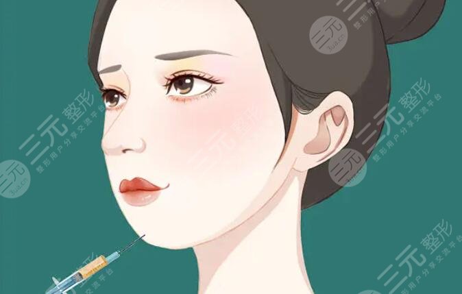 玻尿酸注射