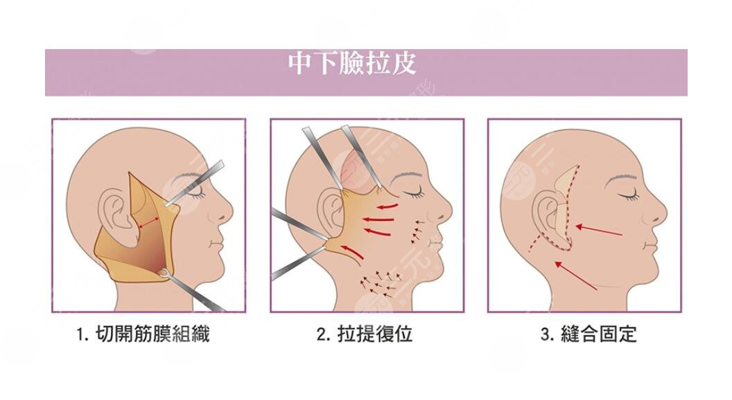 武汉艺星徐国建大拉皮做得怎么样