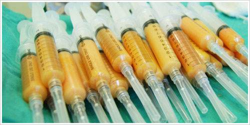 自体脂肪干细胞丰胸有用吗？手术原理、优点分析，美胸指南来咯！