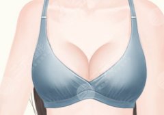 乳房切除后做假体隆胸安全吗?选对医院、医生尤为重要! 乳房切除后做假体隆胸安全吗?选对医院、医生尤为重要!