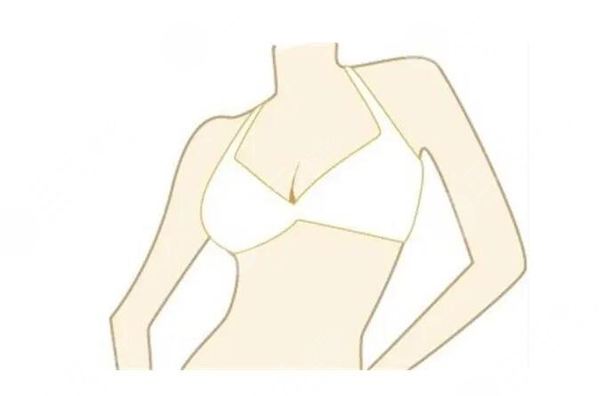 乳房悬吊手术保持几年