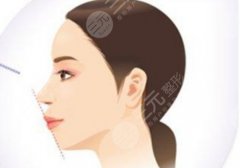 反颌一定要矫正吗?需要注意什么? 反颌一定要矫正吗?需要注意什么?