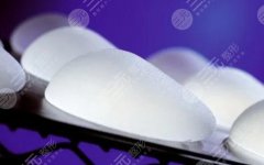 曼托和傲诺拉哪种好?进口隆胸假体品牌对比,图片分享教你挑选~ 曼托和傲诺拉哪种好?进口隆胸假体品牌对比,图片分享教你挑选~