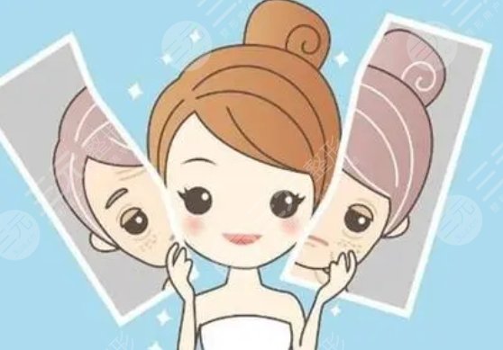 新星靓耿立硕医生激光去皱案例