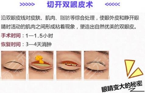 孔伟立医生怎么样?简介分析!长沙双眼皮人气之选,案例来了~