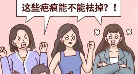 疤痕