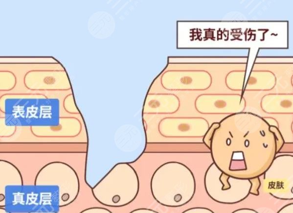 疤痕