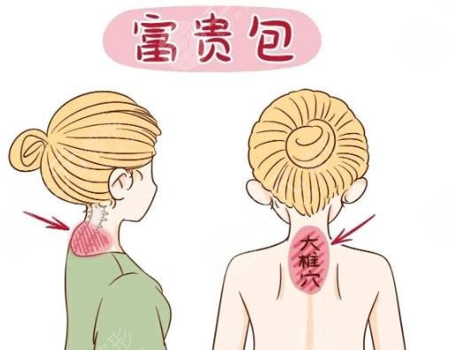 富贵包