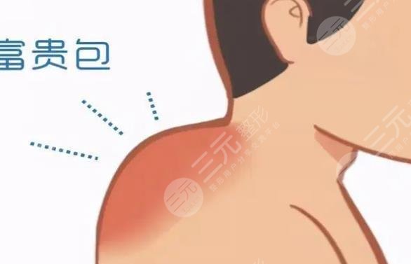 富贵包