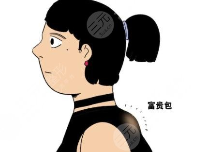 富贵包