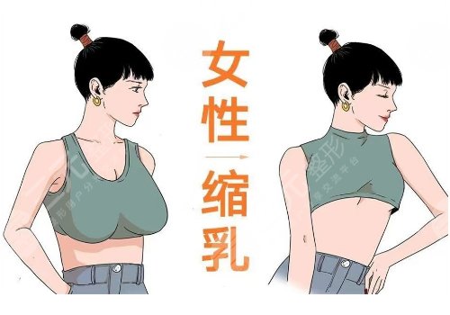宁波第二医院缩胸手术费用