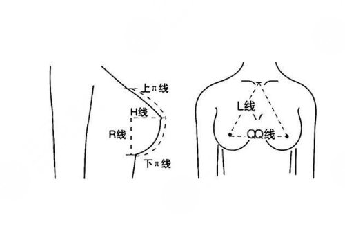 武汉徐国建隆胸案例