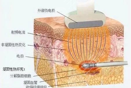 黄金微雕