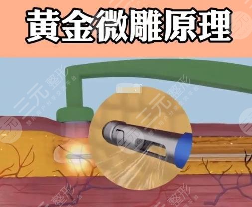 黄金微雕