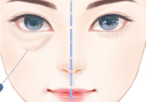 成都金牛纯曦医疗美容门诊部是正规医院吗