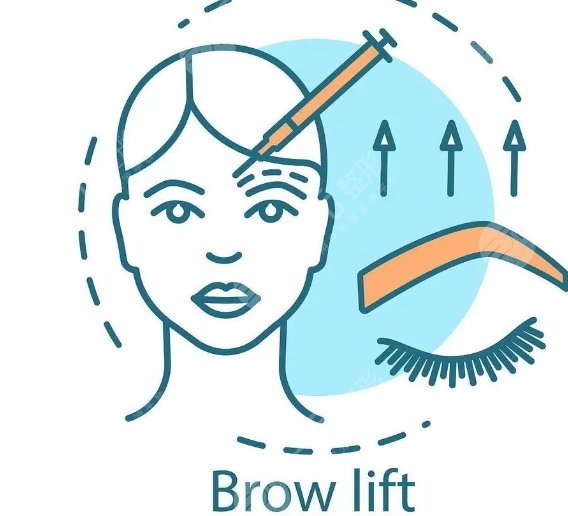 金奇龙医生提眉手术案例