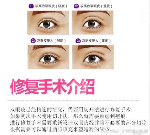 【口碑好医院 优质好医生 点击 →在线咨询←】