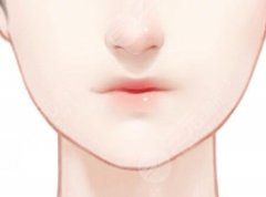 润百颜白紫适合打哪些部位？润百颜白紫能维持多久