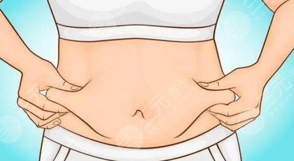 肚子环吸脂