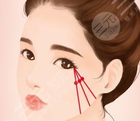 颧骨