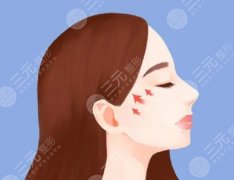 颧骨内推后会反弹吗?颧弓磨骨整形必看,手术一文给你说明白! 颧骨内推后会反弹吗?颧弓磨骨整形必看,手术一文给你说明白!