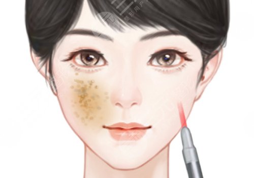 汕头市中心医院祛斑价格