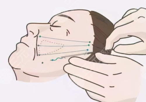 广东涵美医疗美容医院怎么样