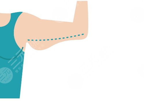 汕头市中心医院整形吸脂多少钱