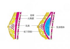 做假体丰胸手术怎么样?恢复期大概多久?美胸指南! 做假体丰胸手术怎么样?恢复期大概多久?美胸指南!