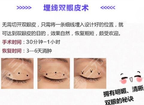 双眼皮