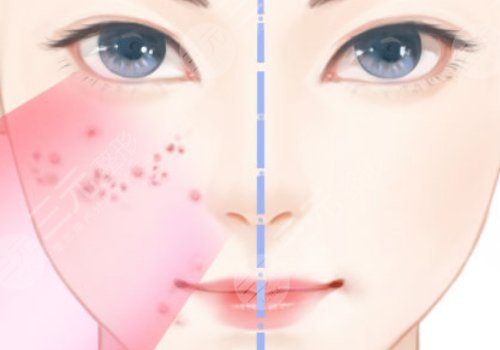 非手术整形美容