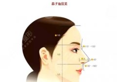 鼻部整容整形常见项目有哪些?美鼻必看指南! 鼻部整容整形常见项目有哪些?美鼻必看指南!