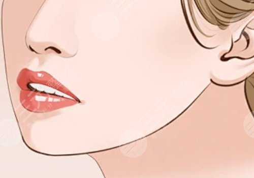 下颚线整形多少钱