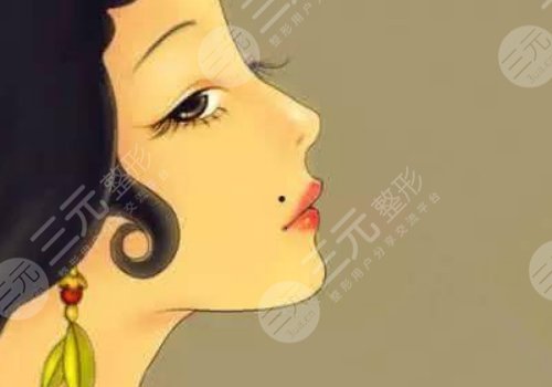 下颚线整形多少钱