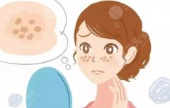 皮秒祛斑10天变化图片讲解!激光美容体验揭秘~ 皮秒祛斑10天变化图片讲解!激光美容体验揭秘~