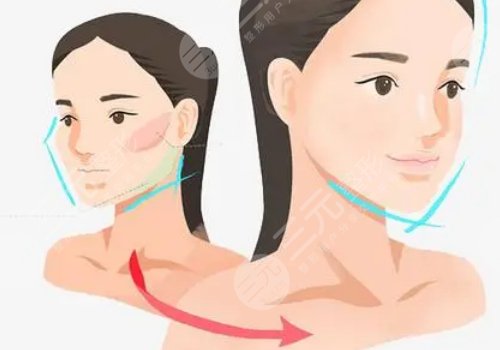 下颌骨歪了怎么矫正