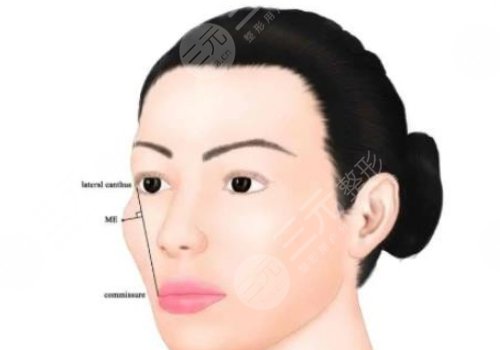颧骨手术费用一般多少