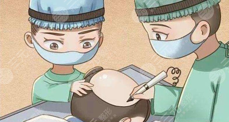 发际线种植术前注意