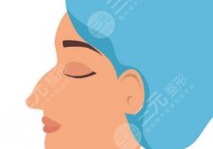 隆鼻膨体和硅胶优缺点对比，哪个材料好？科普一文教会你挑选~