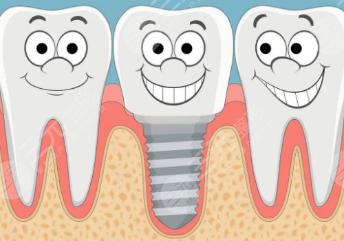 黄丞蔚种牙多久了