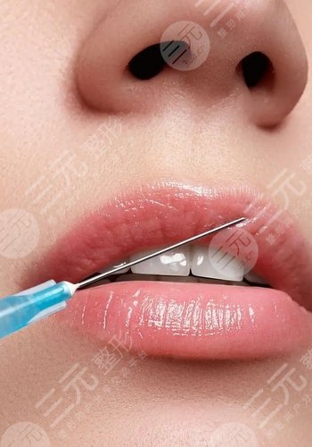 嘴唇整形