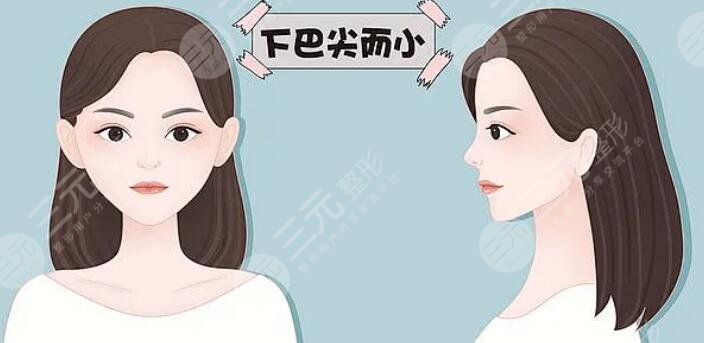丰下巴