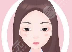 上睑下垂矫
